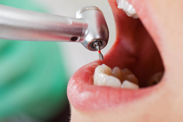 Best Emergency Orthodontic Repairs in Irvine, KY